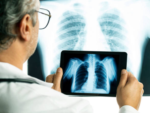 istock Doctor is Observing a Chest Radiograph in a Tablet Computer 1220202415