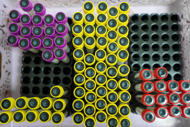 istock top view tube with collection blood samples for research or analyzing a virus in laboratory at hospital 1220273017