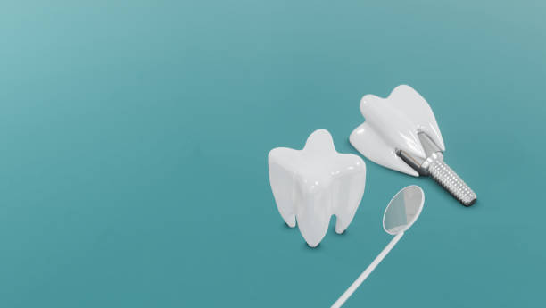 istock Dental Implants surgery concept, dentistry denture, Dental denture on green background. 3D render. 1220274559