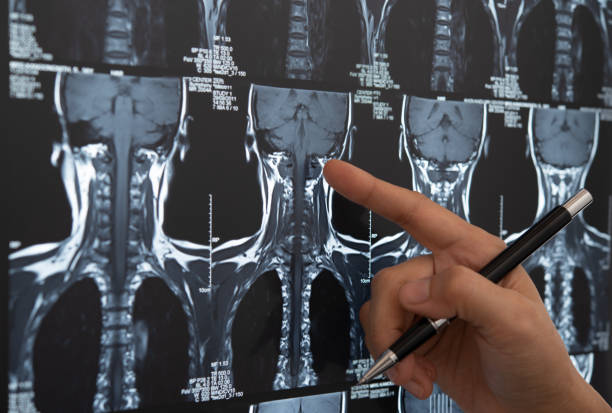 arzt röntgenhirn - mri scanner mri scan patient doctor stock-fotos und bilder