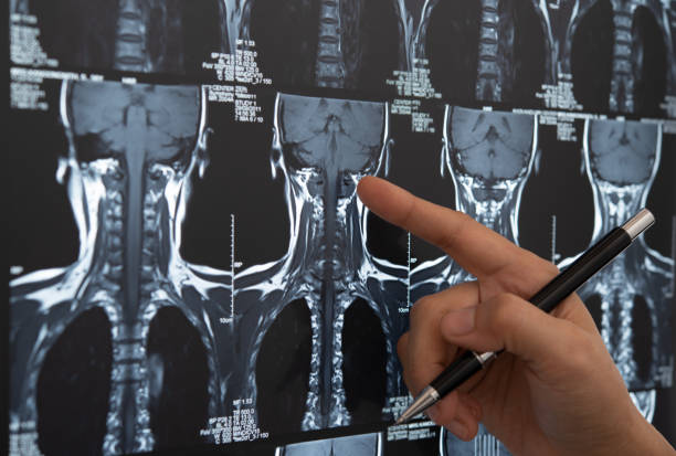 médico cérebro de raio-x - cat scan x ray medical scan x ray image - fotografias e filmes do acervo