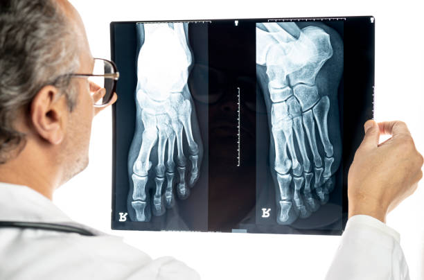 X-ray normal human foot . Lateral view . Invert color style .