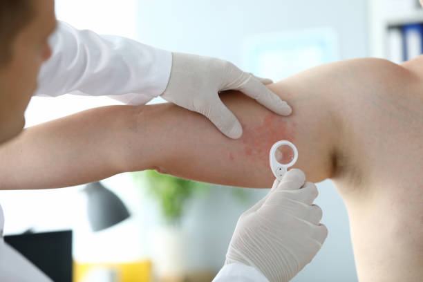 istock Male dermatologist examines rash on leg patient 1220328926