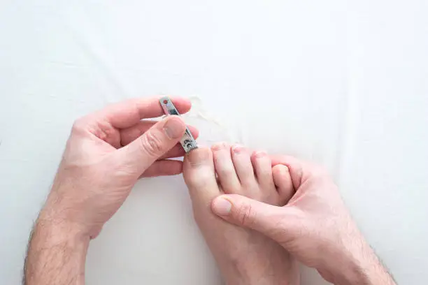 Photo of Caucasian male hand and foot cutting his toenails with a metal nail clipper on a white surface top view close up shot