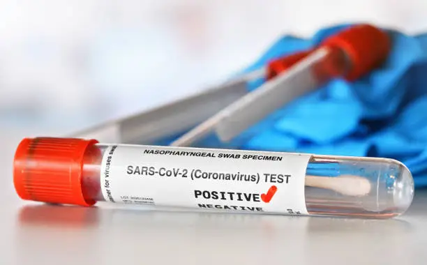 Coronavirus test concept - vial sample tube with cotton swab, red checkmark next to word positive, blurred vials and blue nitrile gloves background. (Sticker is own design with dummy data)