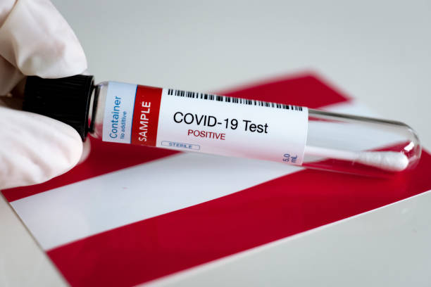 istock Testing for presence of coronavirus in Austria 1220490217