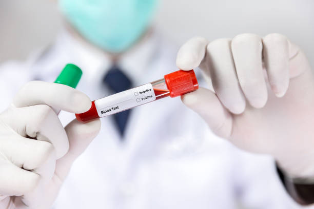 診断ウイルスのための医療検査室での血液管試験またはサンプルを保持する医師の手 - vial laboratory test tube biotechnology ストックフォトと画像