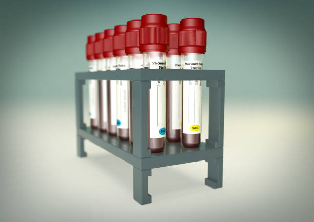 образцы крови мерзкие в нескольких сте�нде держателя - viles стоковые фото и изображения