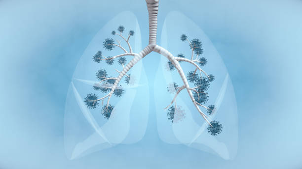 пандемические заболевания в легких - x ray x ray image chest human lung стоковые фото и изображения