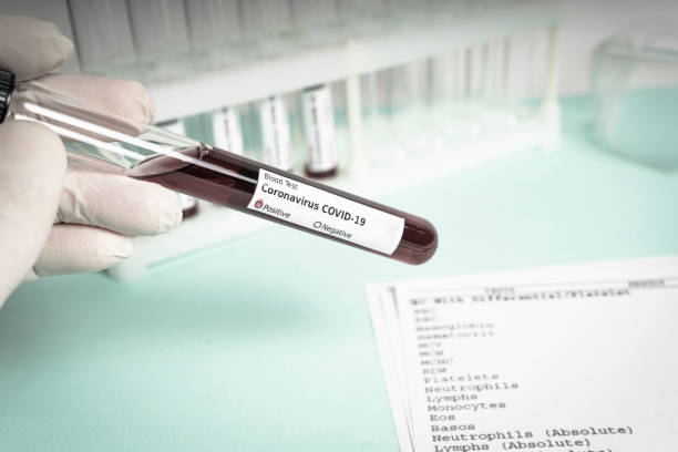 istock Hand holds a test tube containing a test sample 1220722757