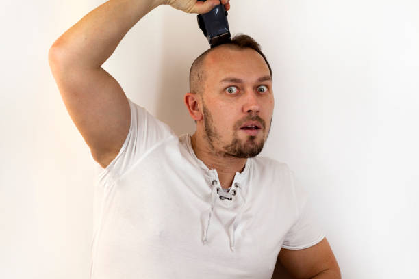 istock Hair problems, struggle with baldness, a man shaves his head with an electric razor 1220994315