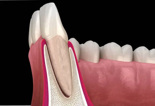 Photo of Morphology of maxillary lateral incisor tooth and gum. Medically accurate dental 3D illustration