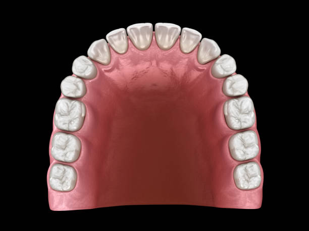 istock U-shape ovoid arch form of maxilla. Medically accurate tooth 3D illustration 1221091102