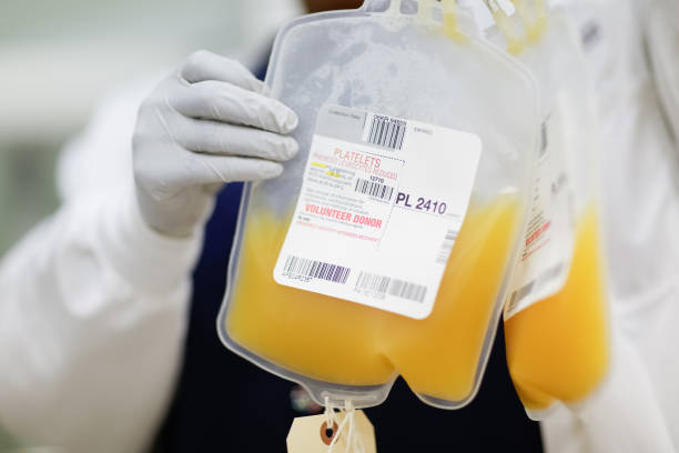 Platelet donation for charity Torrance, CA - May 13, 2013: An unidentified person holds up a donor's platelet donation at a public blood drive in Torrance, California. Platelets are blood products created from centrifuging whole blood and extracting the plasma and platelet into a separate bag. Platelets are then are given to patients undergoing chemo therapy and people lacking clotting factors. Photo was taken by the donor on the afternoon of May 13, 2013. human blood stock pictures, royalty-free photos & images