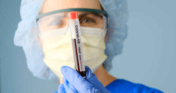travailleur de la santé retenant un conteneur de l’échantillon de test covid-19 - surgical glove human hand holding capsule photos et images de collection