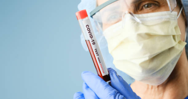 healthcare worker holding a container of covid-19 test sample - surgical glove human hand holding capsule imagens e fotografias de stock