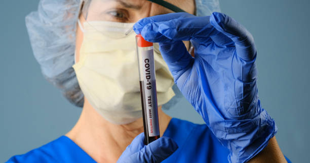 healthcare worker holding a container of covid-19 test blood sample - surgical glove human hand holding capsule imagens e fotografias de stock