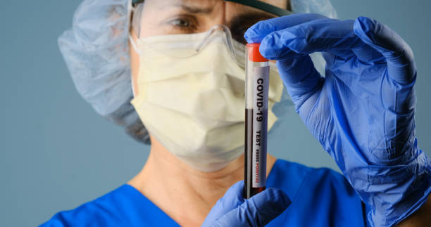 gesundheitspersonal mit einem behälter mit covid-19-testblutprobe - surgical glove human hand holding capsule stock-fotos und bilder
