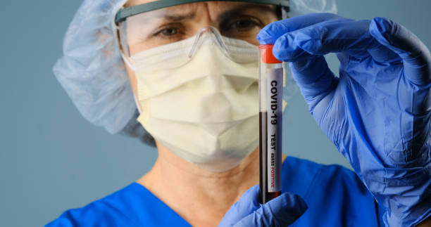 travailleur de la santé retenant un récipient de l’échantillon de sang de test de covid-19 - surgical glove human hand holding capsule photos et images de collection