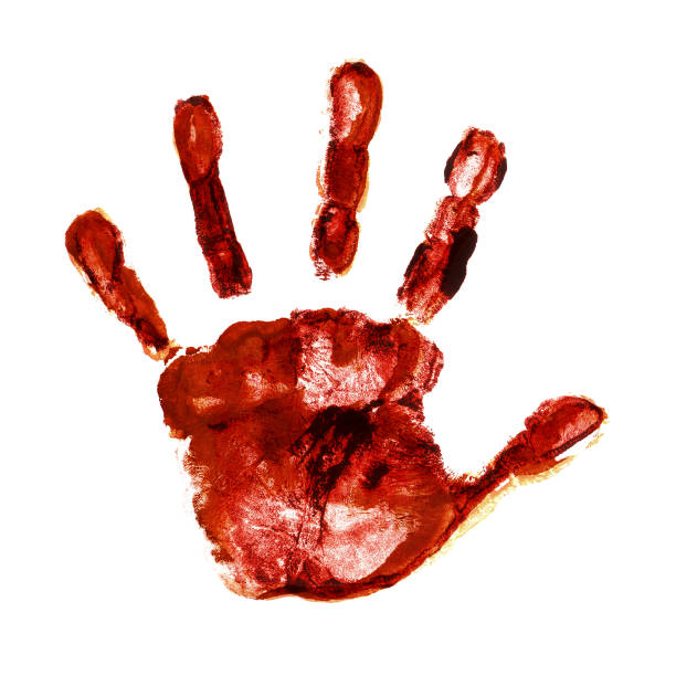 istock Dirty infected palm print 1221357806