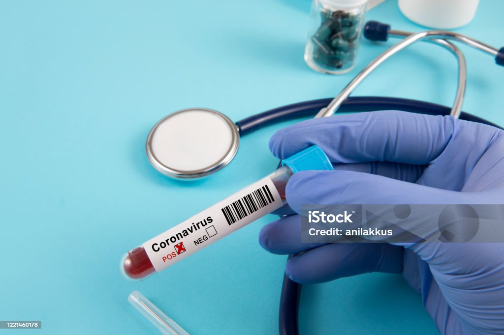 Koronavírus vérvizsgálat - Jogdíjmentes Betegség témájú stock fotó Koronavírus vérvizsgálat - Jogdíjmentes Betegség témájú stock fotó