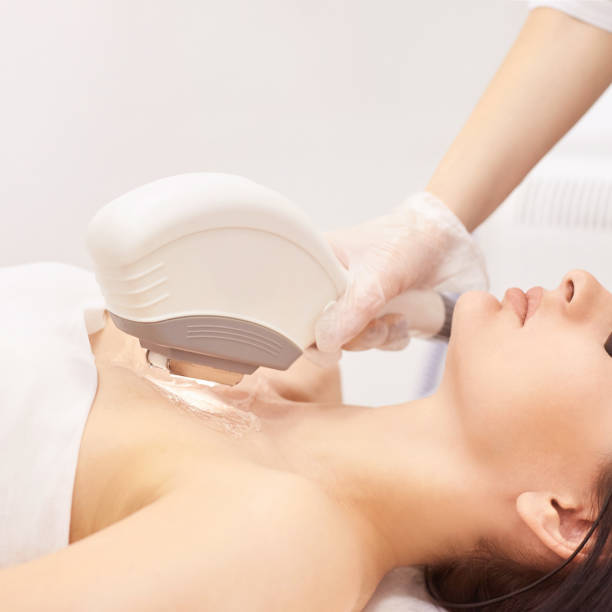 dispositivo médico láser elos. elimine el vello no deseado y los asteriks. procedimiento de spa de cosmetología en el salón. depilación láser decollete - dermatology dermabrasion surgery medical fotografías e imágenes de stock