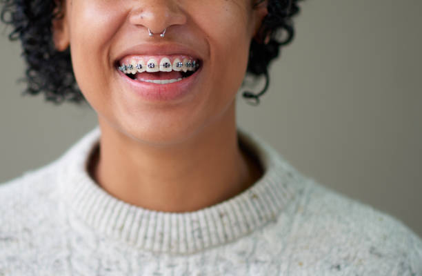 We all smile in the same language Studio shot of a cheerful young woman with braces standing against a grey background septum piercing stock pictures, royalty-free photos & images