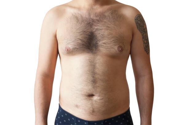 Hairy body of a man, stomach and chest, excessive hairiness, depilation, moles, overweight navel. stock photo