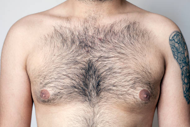 Hairy body of a man, stomach and chest, excessive hairiness, depilation, moles, overweight navel. Hairy body of a man, stomach and chest, excessive hairiness, depilation, moles, overweight navel. hairy fat man pictures stock pictures, royalty-free photos & images