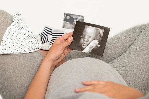 Mujer embarazada sosteniendo imagen de ultrasonido 4D. Expectativa de un niño photo