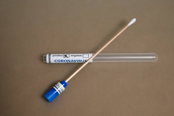 sterilní výtěr drží pozitivní test na covid-19 ncov-2 koronavirus na stole - mrsa - stock snímky, obrázky a fotky