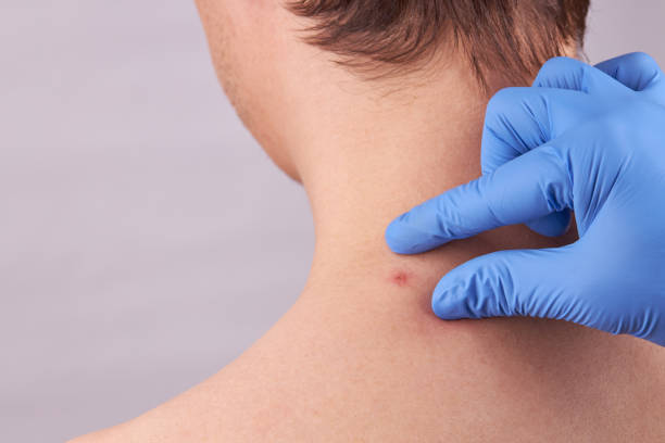 istock caucasian male with skin problems. acne check. skin care concept. 1221659576