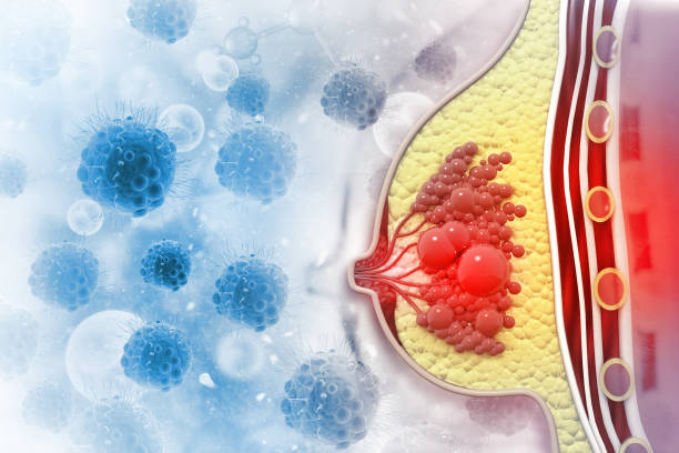 istock Breast cancer, cross section, 3d illustration 1221759524