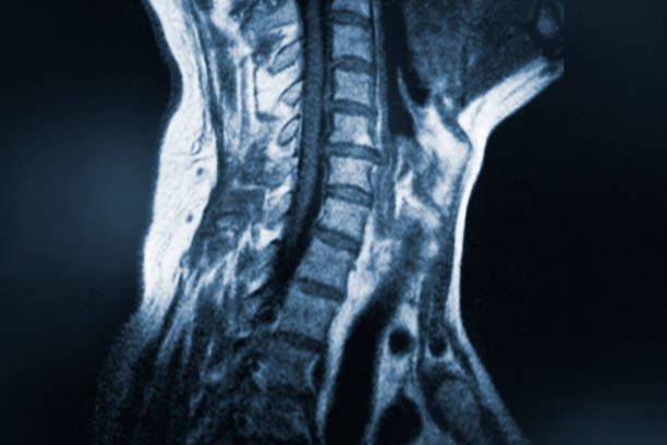 istock Magnetic scanner of the cervical of a patient 1221791058
