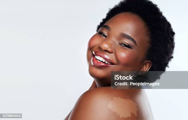 Love Yourself Thats Beautiful Stock Photo - Download Image Now - Skin Care, Vitiligo, Mole - Skin
