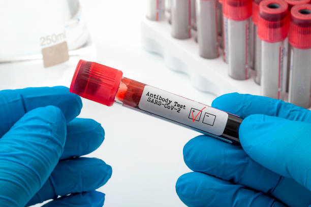 nuovo test degli anticorpi clinici sul coronavirus e concetto diagnostico covid-19 con medico che tiene in mano il campione di plasma sanguigno utilizzato per testare l'antigene sars-cov-2 con un controllo rosso nella casella positiva - componente di organismo vivente foto e immagini stock
