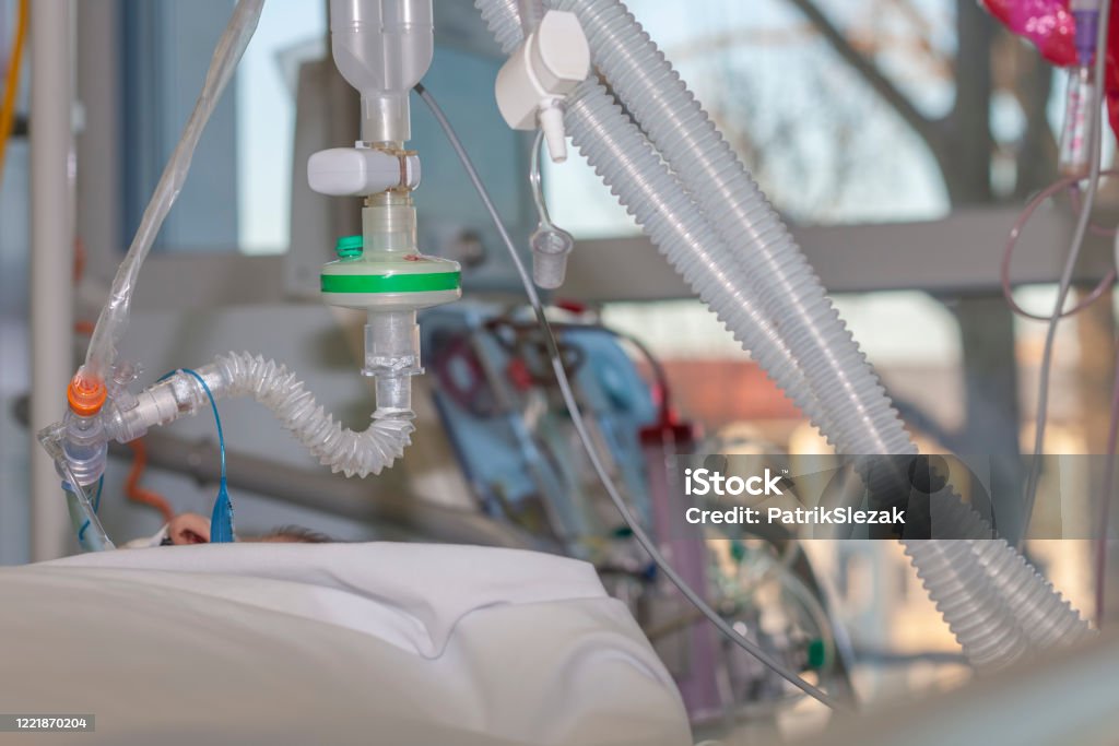 Respiratory connection tube, HME filter, carbon dioxide sensor and suction catheter, patient connected to medical ventilator in ICU in hospital. Respiratory connection tube, HME filter, carbon dioxide sensor and suction catheter, patient connected to medical ventilator in ICU in hospital. On background hemodialysis machine. Hospital Stock Photo