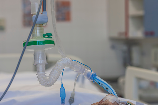 Endotracheal  tube, HME filter, carbon dioxide sensor,  patient connected to medical ventilator in ICU in hospital.