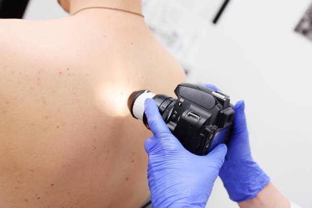 istock Preventing Melanoma and Skin Cancer 1221894177