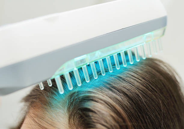 dermatologist performs the procedure of ultraviolet comb to cure psoriasis stock photo