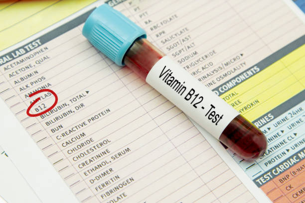 vitamin B12 test vitamin B12 test anemia photos stock pictures, royalty-free photos & images