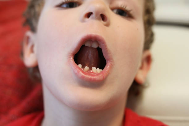 istock Little boy loose and crooked tooth 1221901405