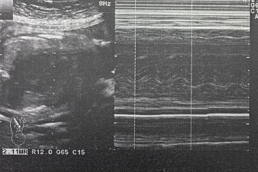 Ultrasound of baby in pregnant woman, Doctor reading test results of pregnant woman by ultrasound.