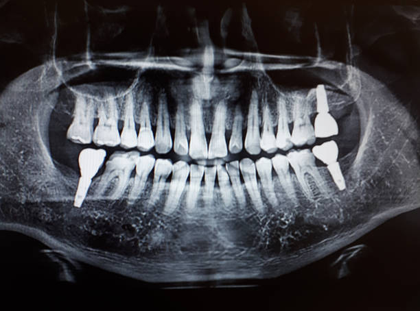 istock Dental photography in dentist. 1221975220