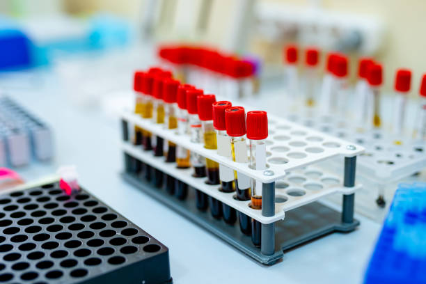 blood samples for research in microtubes. - multi well trays imagens e fotografias de stock