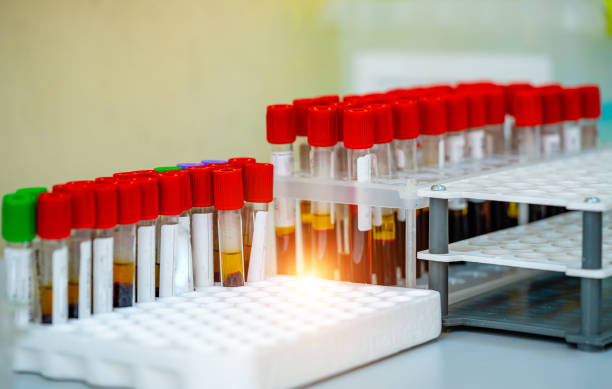 rack of blood tubes test for analysis in the laboratory of hematology. - multi well trays imagens e fotografias de stock