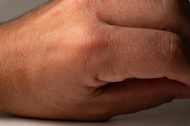istock Hand in detail. 1222028797