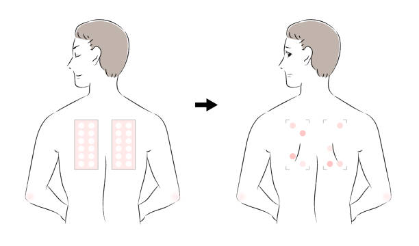 Patch Testing Graphics 6,200+ Patch Test Stock Illustrations, Royalty-Free Vector Graphics ...