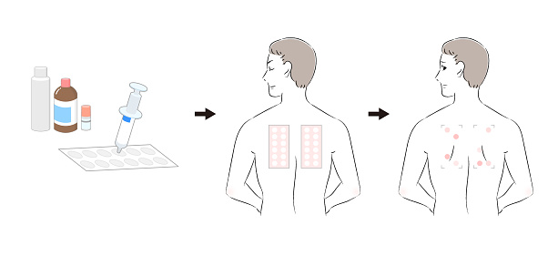 Patch Test Example Patch Test Procedure And Men Taking Patch Test Stock Illustration ...