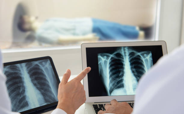 radiografia polmonare radiografica - mri scanner cat scan x ray medical scan foto e immagini stock